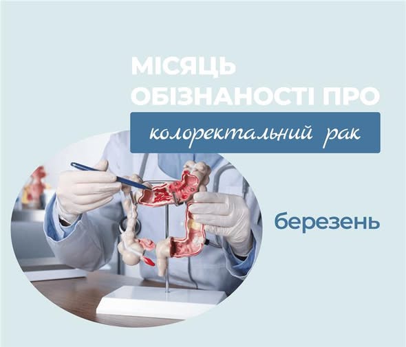 Березень – Місяць обізнаності про колоректальний рак