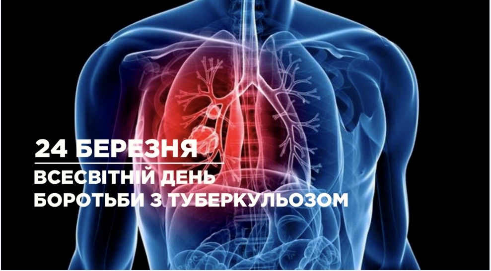 Туберкульоз — це не хвороба минулого